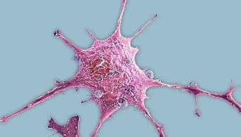 新型分子药物或将革新乳腺癌治疗：揭秘“降解功能”背后的秘密